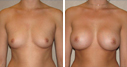Before & After Photos